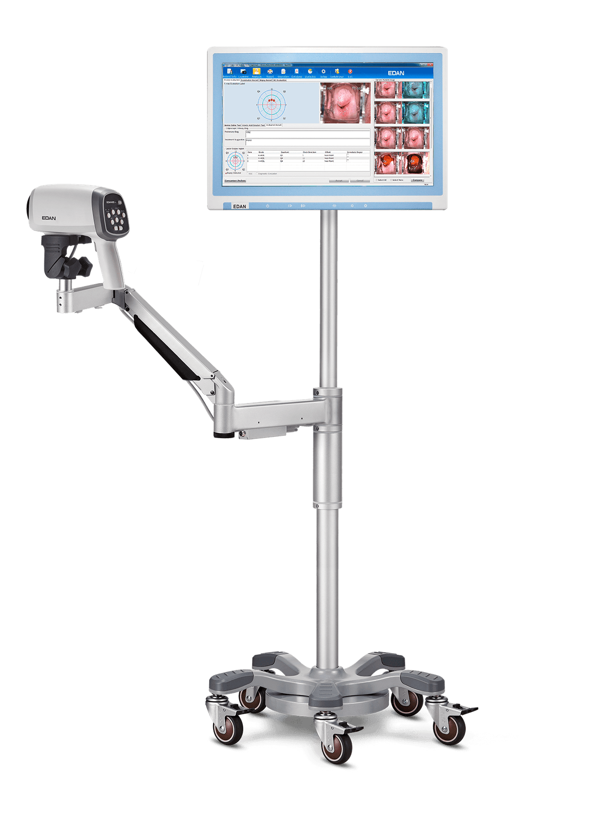 Vіdeo colposcope C6a - Empirica