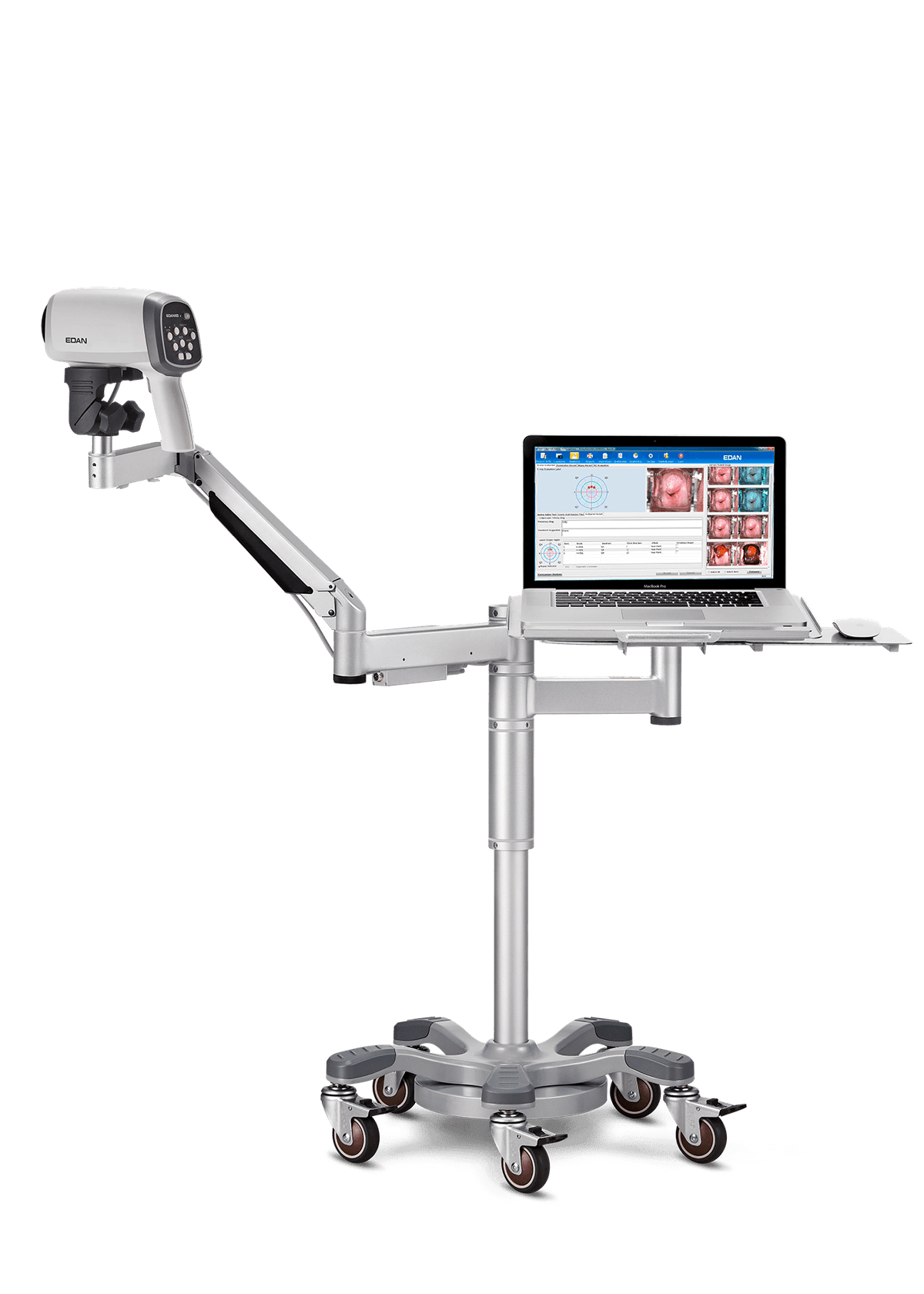 Vіdeo colposcope C6a