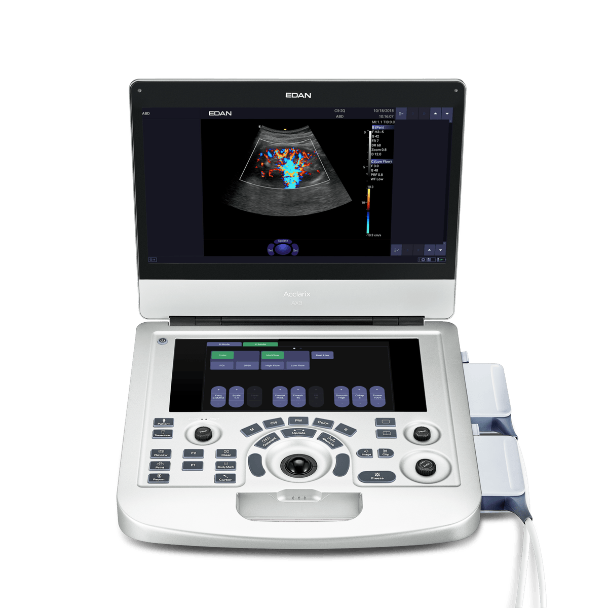 Portable Color Doppler Acclarix AX3