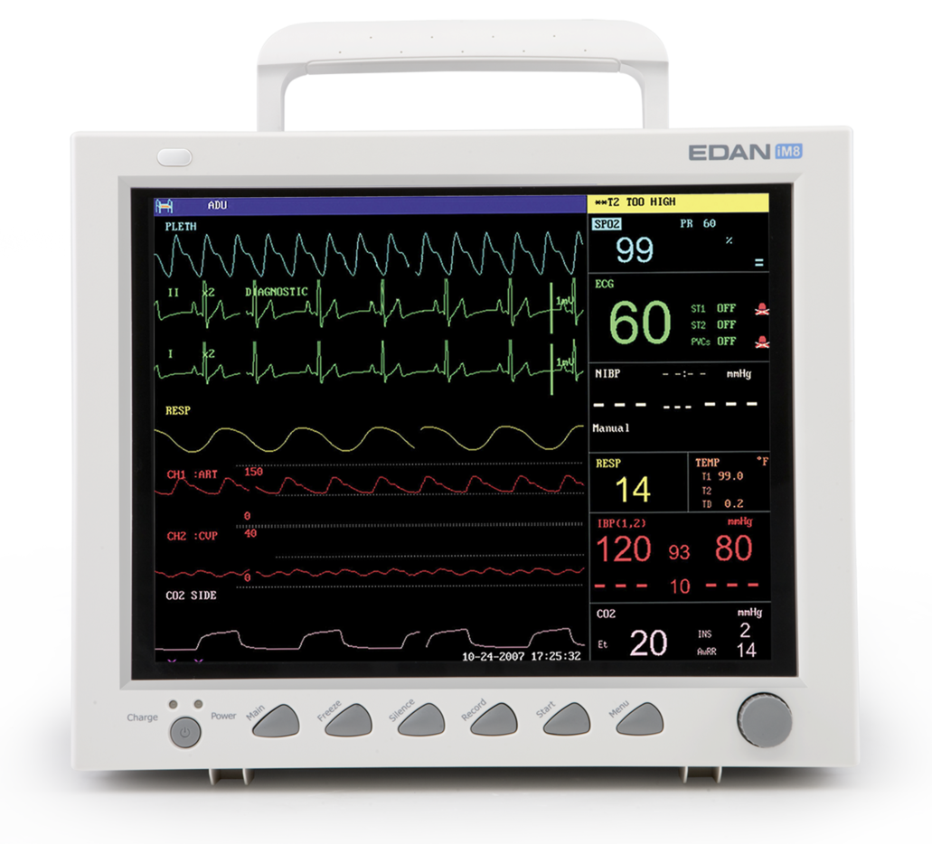 Монітори пацієнта серії iM8 (iM8/8A/8B) - Фото 3
